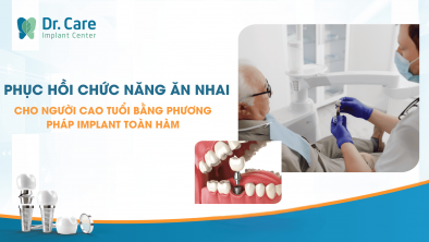 Phục hồi chức năng ăn nhai cho người cao tuổi bằng phương pháp cấy ghép Implant toàn hàm