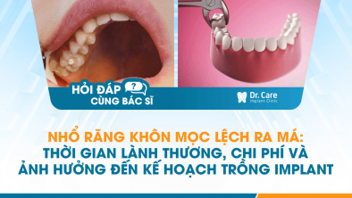 [HỎI ĐÁP BÁC SĨ] - Nhổ răng khôn mọc lệch ra má: Thời gian lành thương, chi phí và ảnh hưởng đến kế hoạch trồng Implant ở tuổi 52