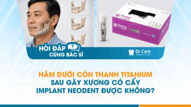 [Hỏi đáp bác sĩ] - Hàm dưới còn thanh titanium sau gãy xương có cấy Implant Neodent được không?