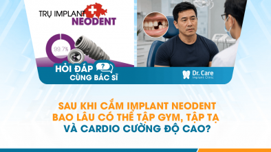 [Hỏi đáp bác sĩ] - Sau khi cắm Implant Neodent bao lâu có thể tập gym, tập tạ và cardio cường độ cao?