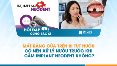 [Hỏi đáp bác sĩ] - Mất răng cửa trên bị tụt nướu có nên xử lý nướu trước khi cắm Implant Neodent không?