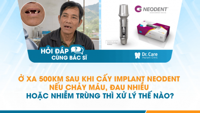 [Hỏi đáp bác sĩ] - Ở xa 500km sau khi cấy Implant Neodent nếu chảy máu, đau nhiều hoặc nhiễm trùng thì xử lý thế nào?