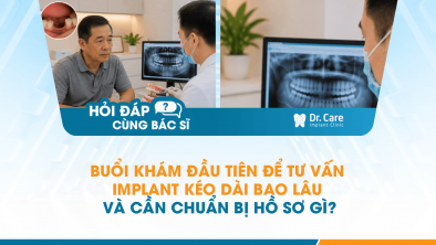 [Hỏi đáp bác sĩ] - Buổi khám đầu tiên để tư vấn Implant kéo dài bao lâu và cần chuẩn bị hồ sơ gì?
