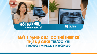 [Hỏi đáp bác sĩ] - Mất 1 răng cửa, có thể thiết kế thử nụ cười trước khi trồng Implant không?