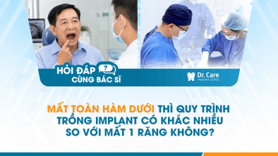 [Hỏi đáp bác sĩ] - Mất toàn hàm dưới thì quy trình trồng Implant có khác nhiều so với mất 1 răng không?