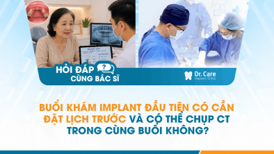 [Hỏi đáp bác sĩ] - Buổi khám Implant đầu tiên có cần đặt lịch trước và có thể chụp CT trong cùng buổi không?