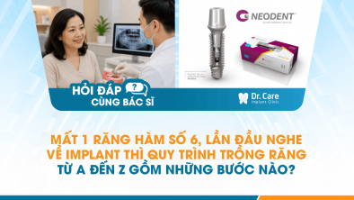 [Hỏi đáp bác sĩ] - Mất 1 răng hàm số 6, lần đầu nghe về Implant thì quy trình trồng răng từ A đến Z gồm những bước nào?