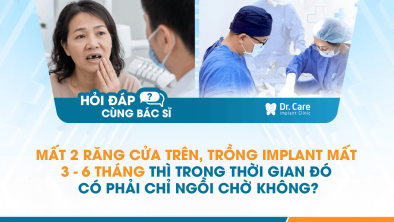 [Hỏi đáp bác sĩ] - Mất 2 răng cửa trên, trồng Implant mất 3–6 tháng thì trong thời gian đó có phải chỉ ngồi chờ không?