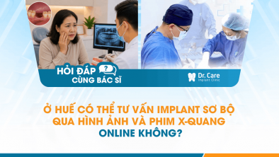 [Hỏi đáp bác sĩ] - Ở Huế có thể tư vấn Implant sơ bộ qua hình ảnh và phim X-quang online không? 
