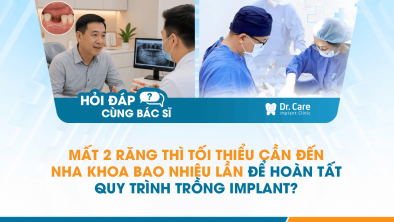 [Hỏi đáp bác sĩ] - Mất 2 răng thì tối thiểu cần đến nha khoa bao nhiêu lần để hoàn tất quy trình trồng Implant?