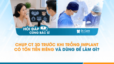 [Hỏi đáp bác sĩ] - Chụp CT 3D trước khi trồng Implant có tốn tiền riêng và dùng để làm gì?