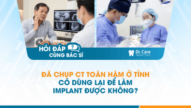 [Hỏi đáp bác sĩ] - Đã chụp CT toàn hàm ở tỉnh, có dùng lại để làm Implant được không?