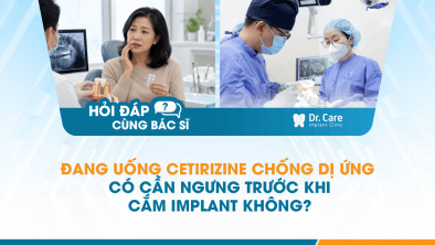  [Hỏi đáp bác sĩ] - Đang uống Cetirizine chống dị ứng có cần ngưng trước khi cắm Implant không?