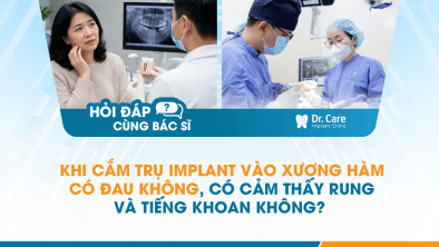 [Hỏi đáp bác sĩ] - Khi cắm trụ Implant vào xương hàm có đau không, có cảm thấy rung và tiếng khoan không?