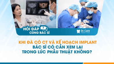 [Hỏi đáp bác sĩ] - Khi đã có CT và kế hoạch Implant, bác sĩ có cần xem lại trong lúc phẫu thuật không?