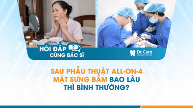 [Hỏi đáp bác sĩ] - Sau phẫu thuật All-on-4 mặt sưng bầm bao lâu thì bình thường?