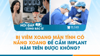 [Hỏi đáp bác sĩ]: Bị viêm xoang mãn tính có nâng xoang để cắm Implant hàm trên được không?