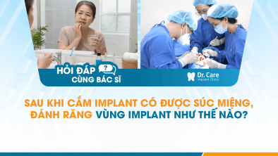  [Hỏi đáp bác sĩ] - Sau khi cắm Implant có được súc miệng, đánh răng vùng Implant như thế nào?