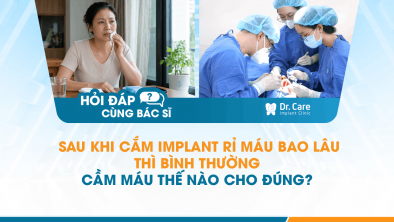 [Hỏi đáp bác sĩ] - Sau khi cắm Implant rỉ máu bao lâu thì bình thường, cầm máu thế nào cho đúng? 