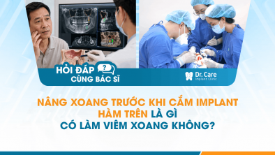 [Hỏi đáp bác sĩ] - Nâng xoang trước khi cắm Implant hàm trên là gì, có làm viêm xoang không?
