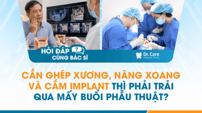 [Hỏi đáp bác sĩ] - Cần ghép xương, nâng xoang và cắm Implant thì phải trải qua mấy buổi phẫu thuật?
