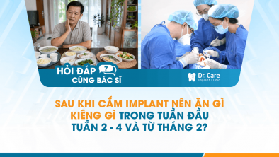 [Hỏi đáp bác sĩ] - Sau khi cắm Implant nên ăn gì, kiêng gì trong tuần đầu, tuần 2–4 và từ tháng 2?