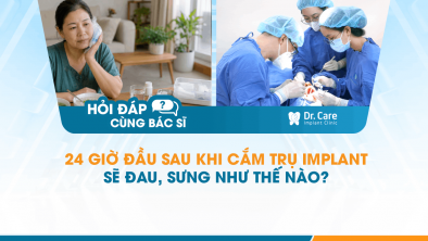 [Hỏi đáp bác sĩ] - 24 giờ đầu sau khi cắm trụ Implant sẽ đau, sưng như thế nào? 