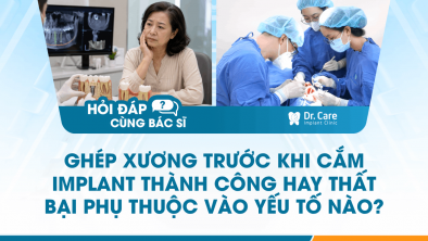 [Hỏi đáp bác sĩ]: Ghép xương trước khi cắm Implant thành công hay thất bại phụ thuộc vào yếu tố nào?