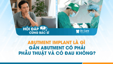 [Hỏi đáp bác sĩ] - Abutment Implant là gì, gắn abutment có phải phẫu thuật và có đau không?
