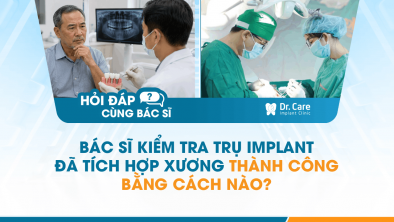 [Hỏi đáp bác sĩ] - Bác sĩ kiểm tra trụ Implant đã tích hợp xương thành công bằng cách nào?