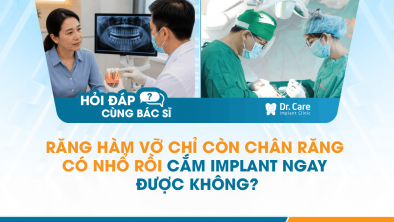 [Hỏi đáp bác sĩ] - Răng hàm vỡ chỉ còn chân răng có nhổ rồi cắm Implant ngay được không?