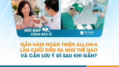 [Hỏi đáp bác sĩ] - Gắn hàm hoàn thiện All-on-6 lần cuối diễn ra như thế nào và cần lưu ý gì sau khi gắn?