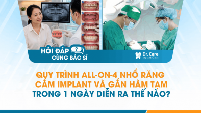 [Hỏi đáp bác sĩ] - Quy trình All-on-4 nhổ răng, cắm Implant và gắn hàm tạm trong 1 ngày diễn ra thế nào?