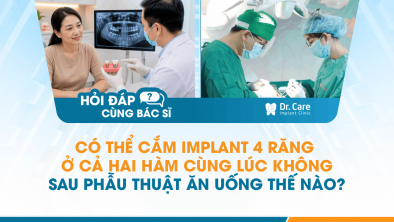 [Hỏi đáp bác sĩ] - Có thể cắm Implant 4 răng ở cả hai hàm cùng lúc không, sau phẫu thuật ăn uống thế nào?