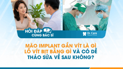 [Hỏi đáp bác sĩ] - Mão Implant gắn vít là gì, lỗ vít bịt bằng gì và có dễ tháo sửa về sau không?