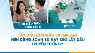 [Hỏi đáp bác sĩ] - Lấy dấu làm mão sứ Implant nên dùng scan 3D hay keo lấy dấu truyền thống?