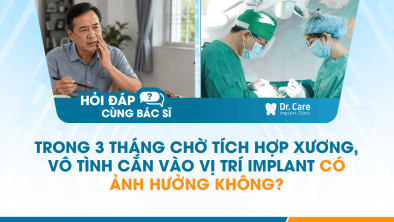 [Hỏi đáp bác sĩ] - Trong 3 tháng chờ tích hợp xương, vô tình cắn vào vị trí Implant có ảnh hưởng không?