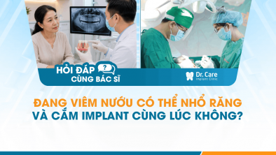 [Hỏi đáp bác sĩ] - Đang viêm nướu có thể nhổ răng và cắm Implant cùng lúc không?