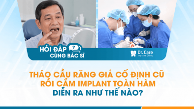 [Hỏi đáp bác sĩ] - Tháo cầu răng giả cố định cũ rồi cắm Implant toàn hàm diễn ra như thế nào?