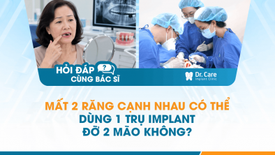 [Hỏi đáp bác sĩ] - Mất 2 răng cạnh nhau có thể dùng 1 trụ Implant đỡ 2 mão không?