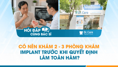 [Hỏi đáp bác sĩ] - Có nên khám 2–3 phòng khám Implant trước khi quyết định làm toàn hàm?