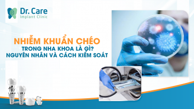 Nhiễm khuẩn chéo trong nha khoa là gì? Nguyên nhân và cách kiểm soát