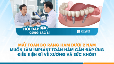 [HỎI ĐÁP BÁC SĨ] - Điều kiện sức khỏe thể nào để có thể trồng răng Implant toàn hàm?