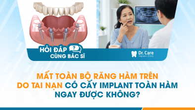 [HỎI ĐÁP BÁC SĨ]: Mất toàn bộ răng hàm trên do tai nạn có cấy Implant toàn hàm ngay được không?