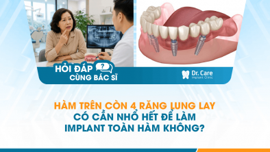 [HỎI ĐÁP BÁC SĨ]: HÀM TRÊN CÒN 4 RĂNG LUNG LAY, CÓ CẦN NHỔ HẾT ĐỂ LÀM IMPLANT TOÀN HÀM KHÔNG?