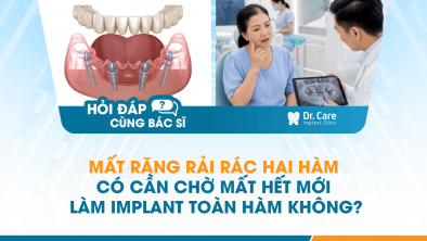 [HỎI ĐÁP BÁC SĨ]: Mất răng rải rác hai hàm có cần chờ mất hết mới làm Implant toàn hàm không?