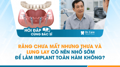 HỎI ĐÁP BÁC SĨ]: Răng chưa mất nhưng thưa và lung lay có nên nhổ sớm để làm Implant toàn hàm không?