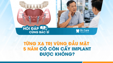 HỎI ĐÁP BÁC SĨ]: Từng xạ trị vùng đầu mặt 5 năm có còn cấy Implant được không?
