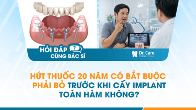 [HỎI ĐÁP BÁC SĨ]: Hút thuốc 20 năm có bắt buộc phải bỏ trước khi cấy Implant toàn hàm không?
