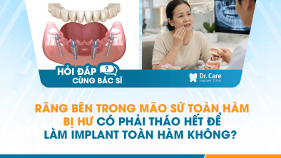 [HỎI ĐÁP BÁC SĨ]: Răng bên trong mão sứ toàn hàm bị hư có phải tháo hết để làm Implant toàn hàm không?
